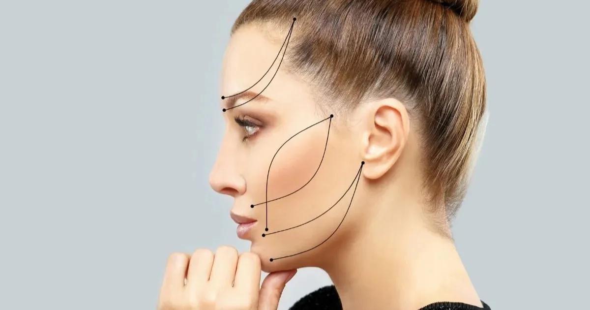 How Endolift in Miami Tightens Sagging Skin?